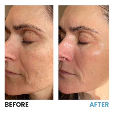 Bio-Collagen Deep Facial Masks (4-pack)