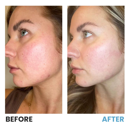 3-in-1 LED Skin Sculptor